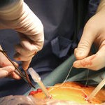 4021068-laparoskopicka-operace-jicnu